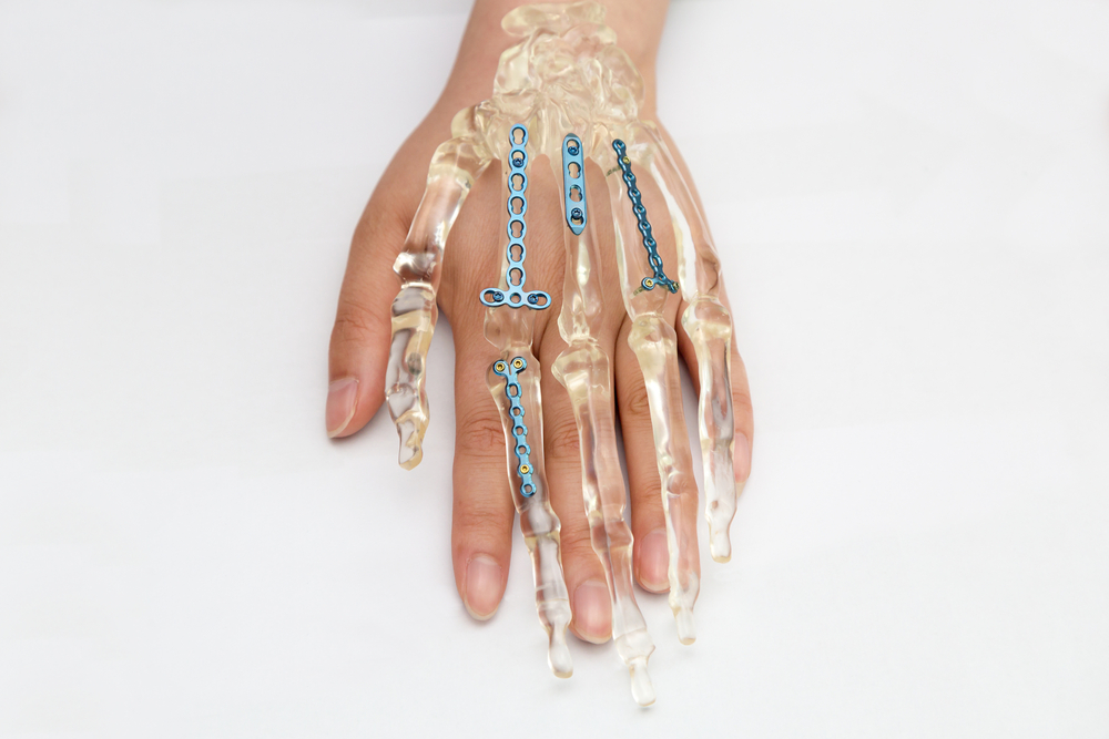 Orthopedic,Medical,Equipment